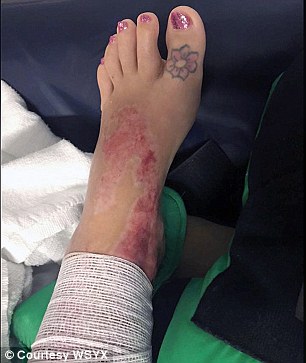woman set on fire