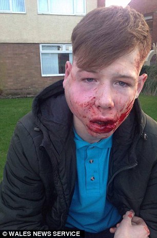 teen bullied