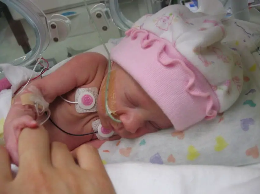 preemie baby