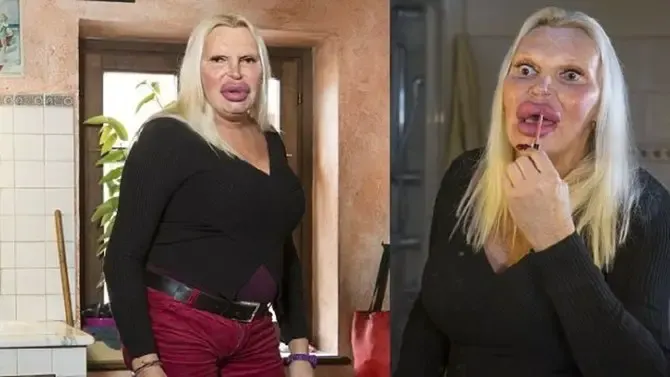 plastic surgery