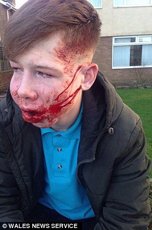 teen bullied