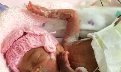 preemie baby