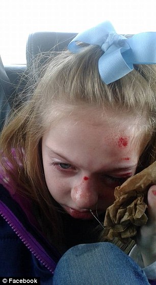 bully hits girl