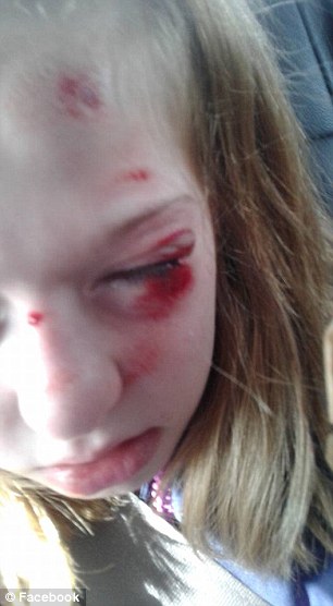 bully hits girl
