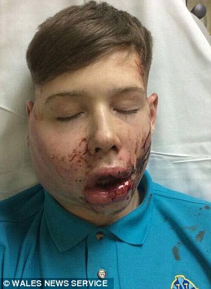 teen bullied