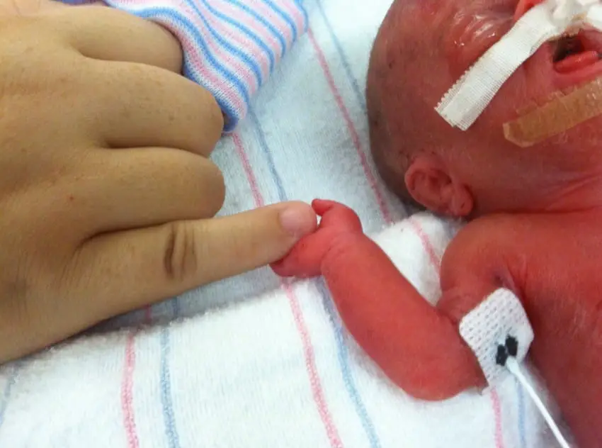 preemie baby