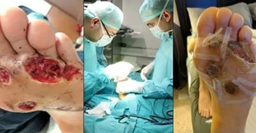 Everyone Thinks 35-Year-Old Alcoholic Is Pregnant, But There’s No Baby Inside Her Giant Belly