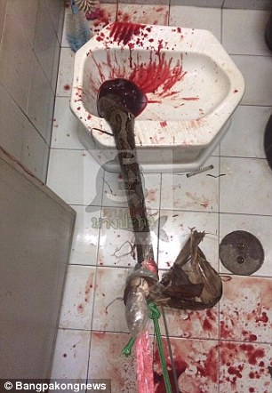 python bites man