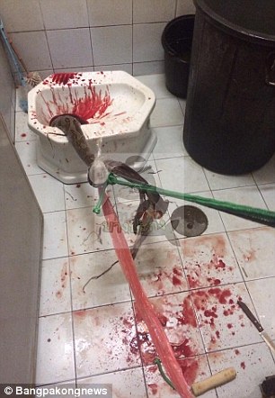 python bites man