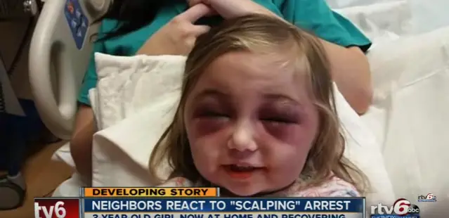 man scalps toddler