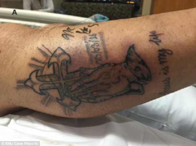 man dies because of tattoo