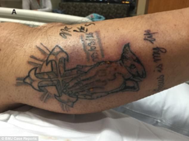 man dies because of tattoo