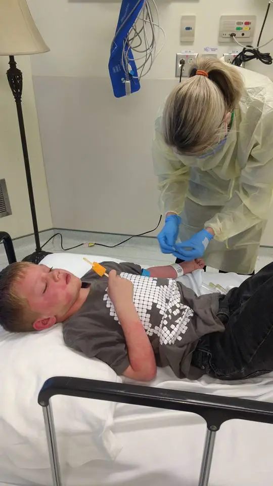 son with measles