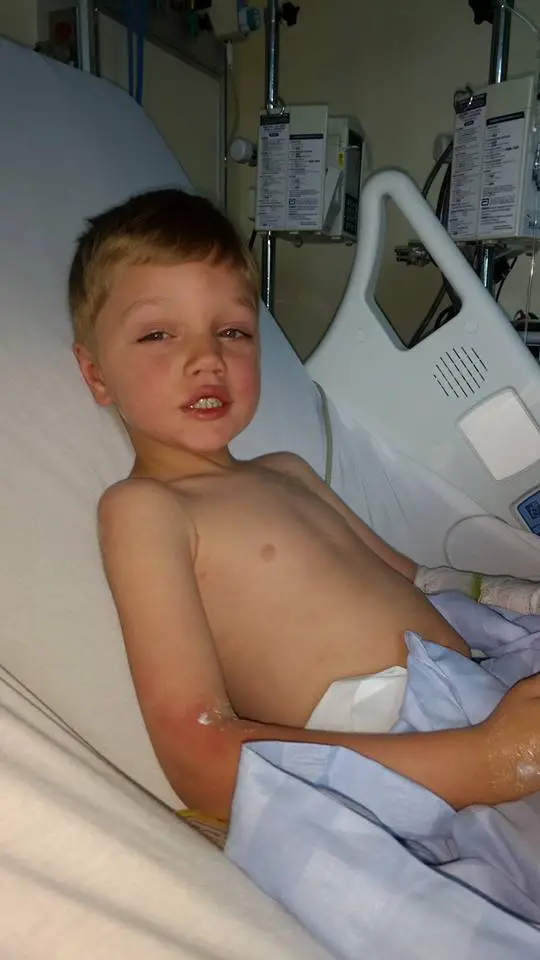 son with measles