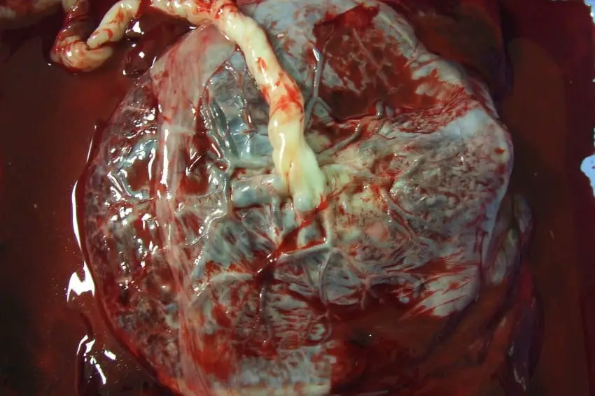 moms eating placenta