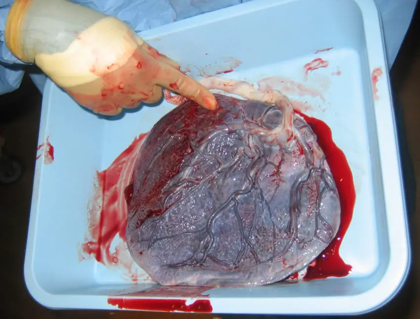 moms eating placenta
