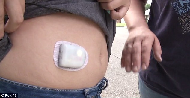 insulin pump