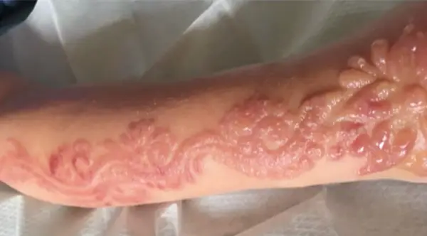 black henna tattoo