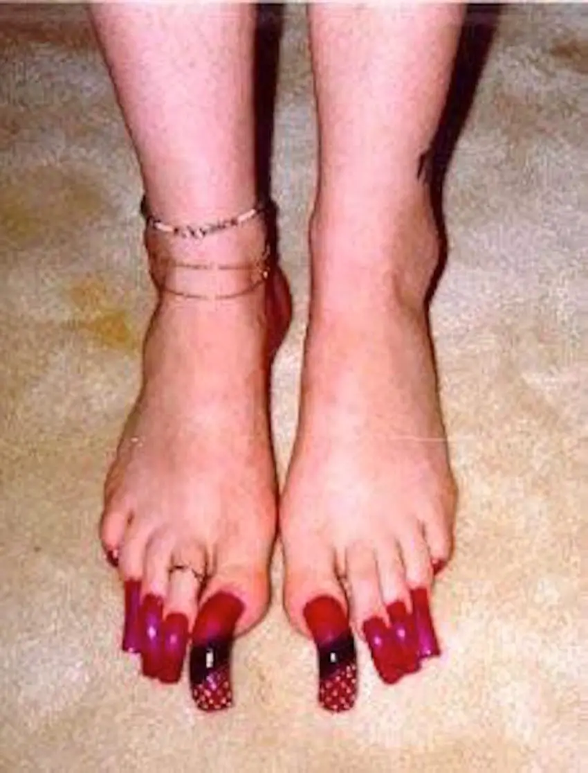 10 Extremely Long Toenails You Have To See In Order To Believe Page 3 Of 3 Relay Hero