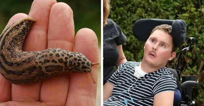 swallowing-slug-man-left-paralyzed