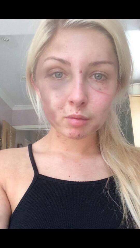 man beats girl