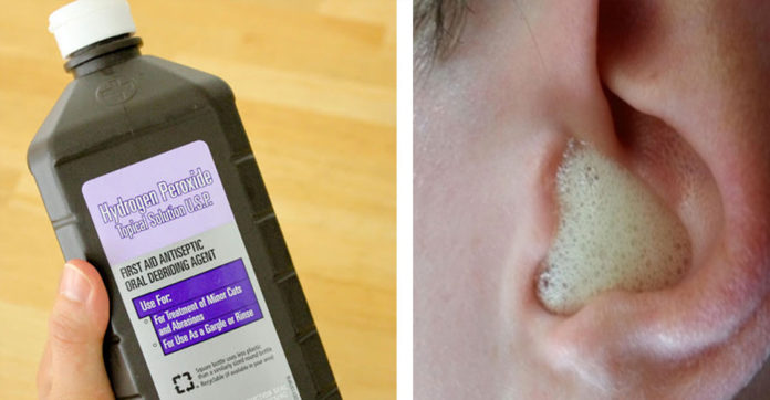 hydrogen-peroxide-uses