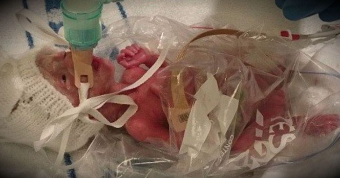 premie-baby-sandwich-bag-2 premie baby sandwich bag