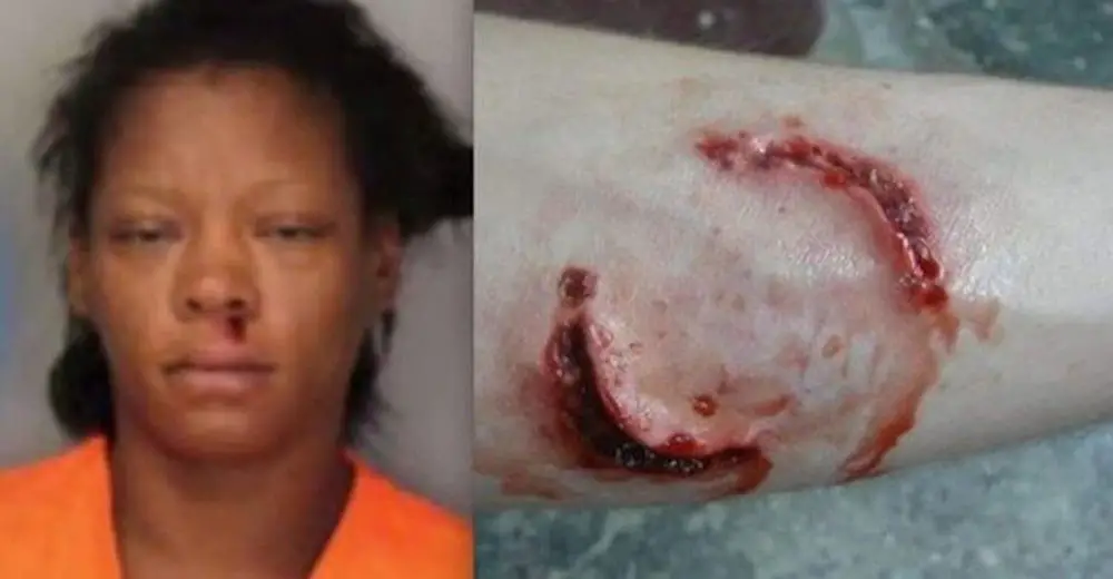 Woman Bites Cop During Arrest, Test Of Her Saliva Reveals ...