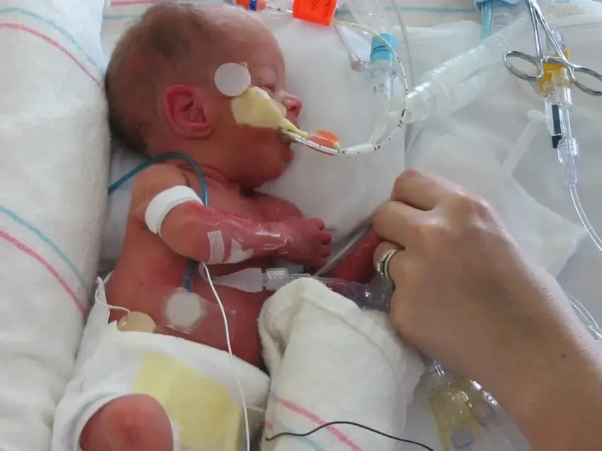 preemie baby