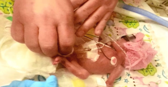 baby born at 24 weeks had feet the size of pennies 9 months later size of pennies with photo