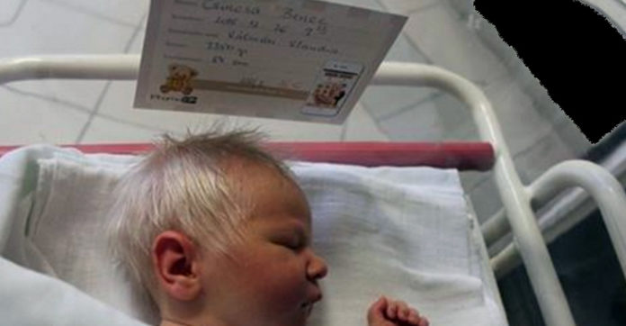 Doctors Finally Realize Why Baby Was Born With Head Full Of Grey