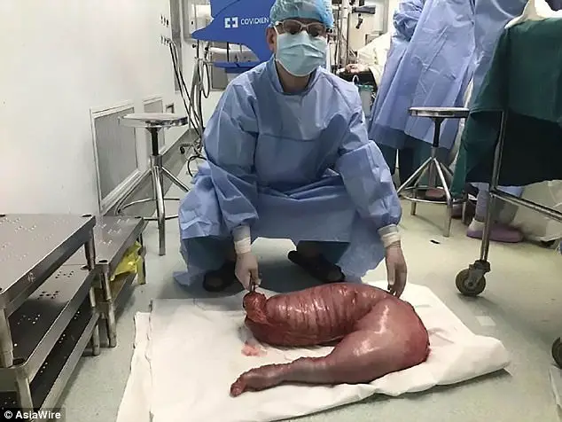 30 pounds of faeces