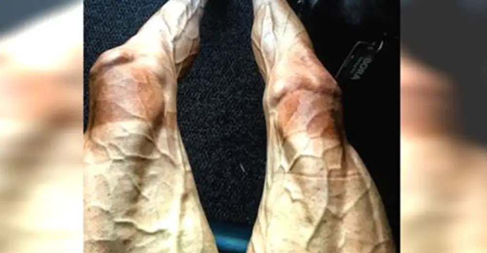 27-Year-Old Cyclist Posts Photo Of His Legs After Biking 1,700 Miles In