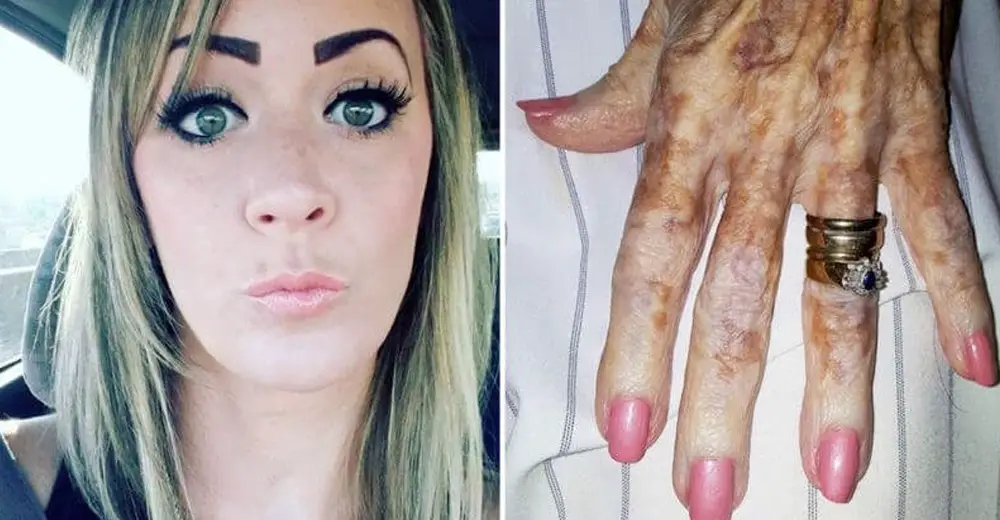 Elderly Lady Is Ashamed Of Her ‘Ugly’ Hands, Until A Nurse Explains