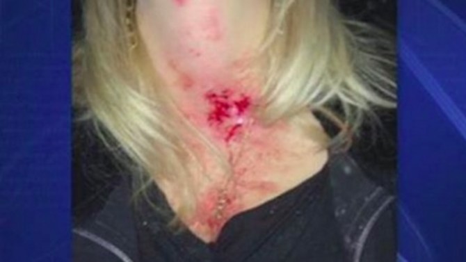 rock in the neck