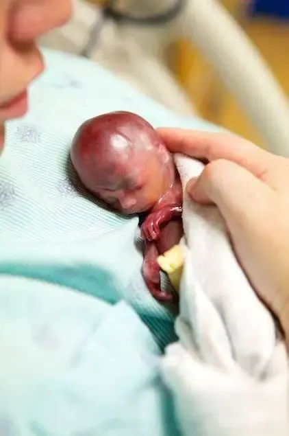 premature baby and mother