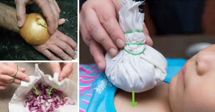 onions-great-remedy