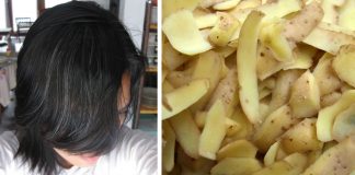 grey hair potato skins