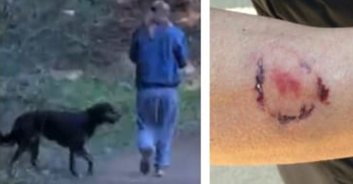 dog-owner-bites-woman dog owner bites woman