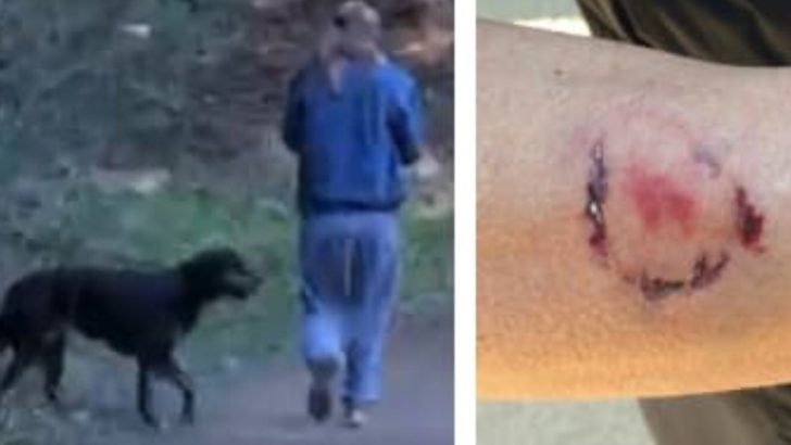 dog owner bites woman