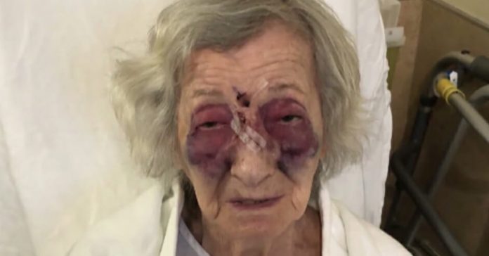 hanka-fogelman-beaten-by-stranger hanka fogelman beaten by stranger