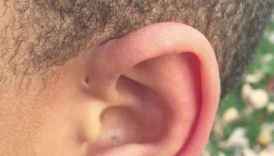 hole above your ear