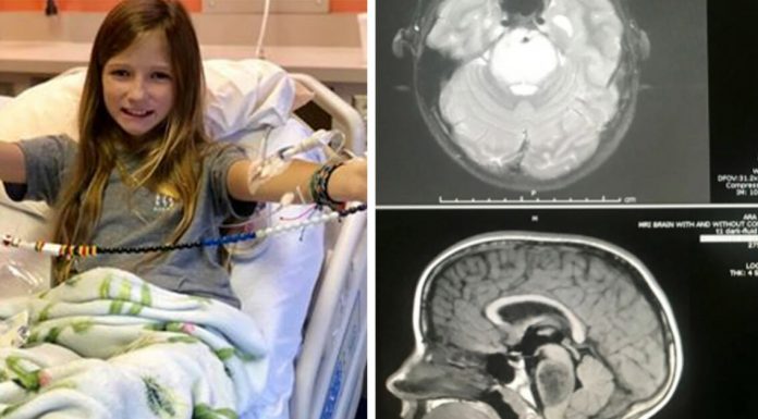 11-year-old brain tumor disappears