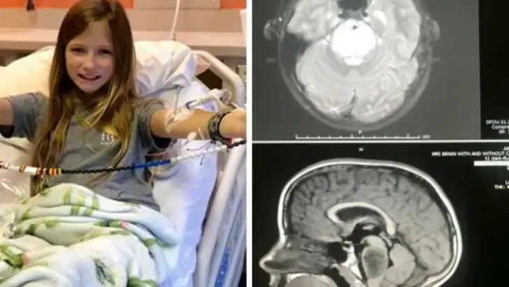 11-year-old brain tumor disappears