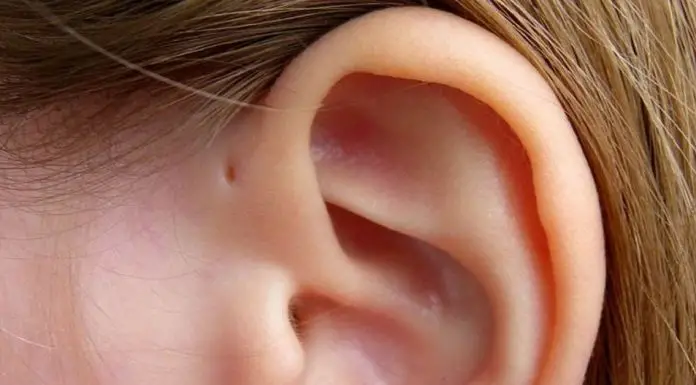hole above your ear