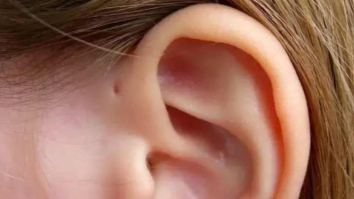 hole above your ear