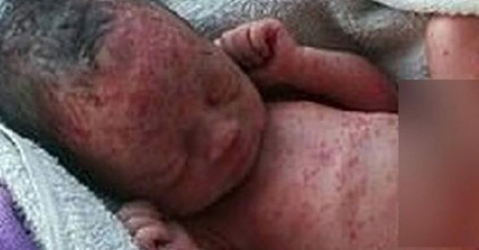 baby-girl-found-in-a-field baby girl found in a field