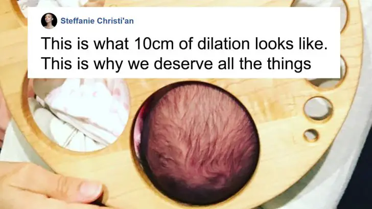 dilation chart childbirth