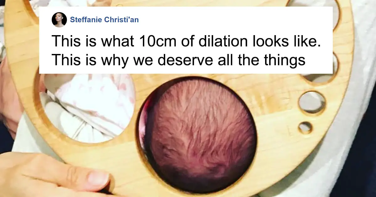 This Dilation Chart Shows The Remarkable Reality Of Childbirth this-dilation-chart-shows-the-remarkable-reality-of-childbirth