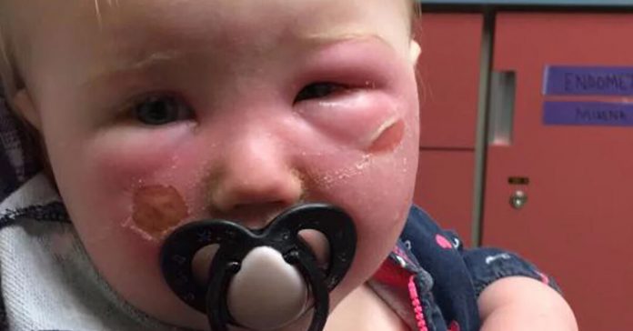 warning-aerosol-sunscreens